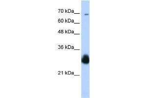 Transfected 293T; WB Suggested Anti-RNF138 Antibody Titration: 0. (RNF138 anticorps  (C-Term))