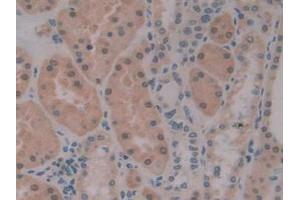 Figure. (PKIB anticorps  (AA 8-76))