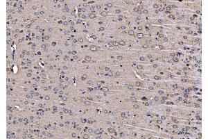 IHC analysis of ARFGAP1 using anti-ARFGAP1 antibody (ABIN4886474). (ARFGAP1 anticorps  (AA 1-183))