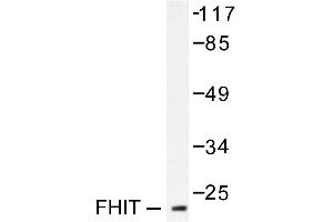 Image no. 2 for anti-Fragile Histidine Triad (FHIT) antibody (ABIN265419) (FHIT anticorps)