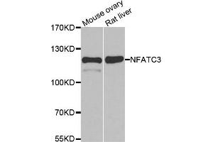 Western blot analysis of extracts of various cell lines, using NFATC3 antibody. (NFATC3 anticorps)