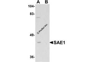 Western Blotting (WB) image for anti-SUMO1 Activating Enzyme Subunit 1 (SAE1) (C-Term) antibody (ABIN1030635) (SAE1 anticorps  (C-Term))