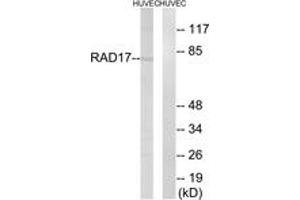 Western blot analysis of extracts from HuvEc cells, using RAD17 (Ab-645) Antibody. (RAD17 anticorps  (AA 621-670))