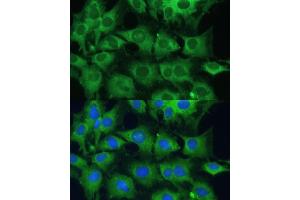 Immunofluorescence analysis of C6 cells using PTPN22 antibody (ABIN3021952, ABIN3021953, ABIN1513449 and ABIN6218285) at dilution of 1:100.