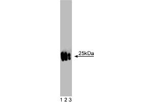 Western blot analysis of MnSOD on a mouse kidney lysate. (SOD2 anticorps  (AA 114-220))