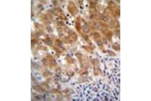Formalin fixed and paraffin embedded human liver tissue reacted with Fumarylacetoacetase Antibody (N-term) Cat.