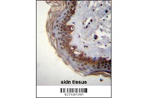 RBM42 Antibody immunohistochemistry analysis in formalin fixed and paraffin embedded human skin tissue followed by peroxidase conjugation of the secondary antibody and DAB staining. (RBM42 anticorps  (C-Term))