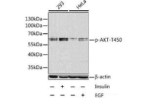 Western blot analysis of extracts of 293 and HeLa cells using Phospho-AKT(T450) Polyclonal Antibody at dilution of 1:1000. (AKT1 anticorps  (pThr450))