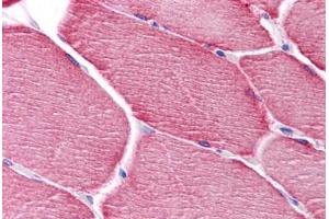 Human Skeletal Muscle: Formalin-Fixed, Paraffin-Embedded (FFPE)