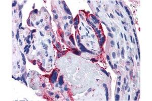 IHC testing of FFPE human placenta tissue with APH1A antibody at 5ug/ml. (APH1A anticorps)