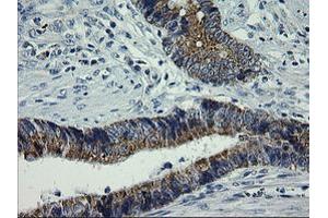 Image no. 2 for anti-Armadillo Repeat Containing 1 (ARMC1) antibody (ABIN1496727) (ARMC1 anticorps)