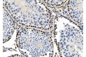 ABIN6259049 and ABIN6273584 at 1/100 staining Mouse testis tissue by IHC-P. (EBNA1BP2 anticorps  (Internal Region))