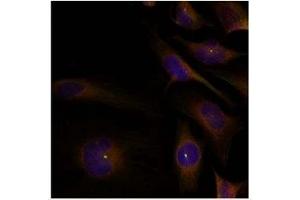 Image no. 1 for anti-Cofilin 1 (CFL1) (Tyr88) antibody (ABIN319381)