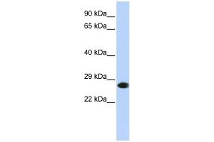 WB Suggested Anti-PSMA2 Antibody Titration: 0.