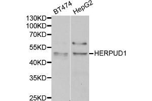 Western blot analysis of extracts of various cell lines, using HERPUD1 antibody (ABIN5975082) at 1/1000 dilution.