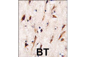 Formalin-fixed and paraffin-embedded human brain tissue reacted with MOBKL1A polyclonal antibody  , which was peroxidase-conjugated to the secondary antibody, followed by DAB staining . (MOBKL1A anticorps  (C-Term))
