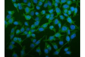 IF analysis of SEC14L3/TAP2 using anti-SEC14L3/TAP2 antibody (ABIN7601623). (SEC14L3 anticorps  (AA 4-400))