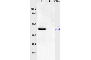 L1 mouse brain lysates L2 human colon carcinoma lysates probed with Anti - phospho-JNK1/2/3 (Thr183+Tyr185) Polyclonal Antibody, Unconjugated (ABIN732368) at 1:200 in 4 °C. (JNK anticorps  (pThr183, pTyr185))