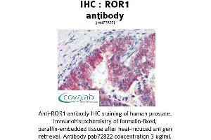 Image no. 1 for anti-Receptor Tyrosine Kinase-Like Orphan Receptor 1 (ROR1) (C-Term) antibody (ABIN1738934) (ROR1 anticorps  (C-Term))