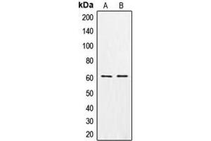 Western blot analysis of CSGALNACT1 expression in MCF7 (A), K562 (B) whole cell lysates. (CSGALNACT1 anticorps  (Center))