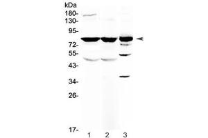 Western blot testing of 1) rat brain, 2) mouse brain and 3) human HepG2 antibody at 0. (NSF anticorps)