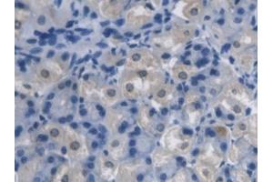 Detection of PCYOX1 in Mouse Stomach Tissue using Polyclonal Antibody to Prenylcysteine Oxidase 1 (PCYOX1)