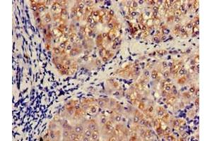 Immunohistochemistry of paraffin-embedded human liver tissue using ABIN7145998 at dilution of 1:100