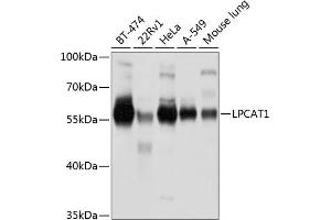 Western blot analysis of extracts of various cell lines, using LPC antibody (ABIN6130983, ABIN6143295, ABIN6143296 and ABIN6220819) at 1:1000 dilution. (LPCAT1 anticorps  (AA 325-534))