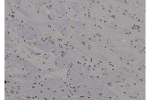 ABIN6277278 at 1/100 staining Rat brain tissue by IHC-P. (SKP1 anticorps  (Internal Region))