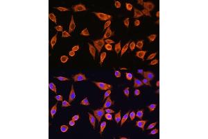 Immunofluorescence analysis of L929 cells using RPS28 Rabbit pAb (ABIN7270024) at dilution of 1:100. (RPS28 anticorps)