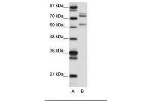Image no. 1 for anti-GATA Zinc Finger Domain Containing 2B (GATAD2B) (AA 61-110) antibody (ABIN6736149)