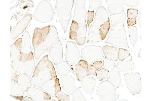 Immunohistochemistry (IHC) image for anti-Myoglobin (MB) antibody (ABIN7795605) (Myoglobin anticorps)
