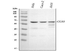 anti-Chromosome 6 Open Reading Frame 150 (C6orf150) (AA 208-522) antibody