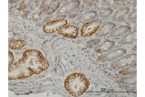 Immunoperoxidase of monoclonal antibody to TLN1 on formalin-fixed paraffin-embedded human small Intestine.