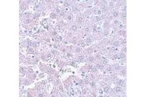 Immunohistochemistry of CALHM1 in rat liver tissue with CALHM1 antibody at 5 μg/ml. (CALHM1 anticorps  (N-Term))