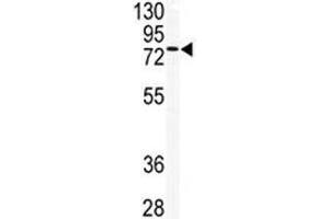 Western blot analysis of TLK2 antibody and mouse testis tissue lysate. (TLK2 anticorps  (AA 141-171))