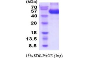 SDS-PAGE (SDS) image for Ciliary Neurotrophic Factor Receptor (CNTFR) (AA 23-342) protein (His tag) (ABIN5854746)