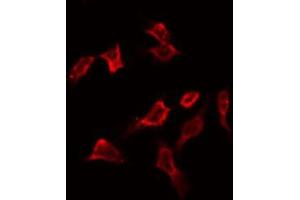 ABIN6266904 staining HeLa by IF/ICC. (PFKFB1/4 anticorps)