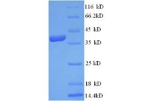 Dermcidin (DCD) (AA 20-110) protein (GST tag)