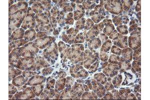 Image no. 7 for anti-Ras Homolog Gene Family, Member J (RHOJ) antibody (ABIN1501341)