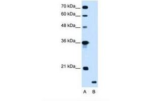 Image no. 1 for anti-Ring Finger Protein 175 (RNF175) (AA 58-107) antibody (ABIN341280) (RNF175 anticorps  (AA 58-107))