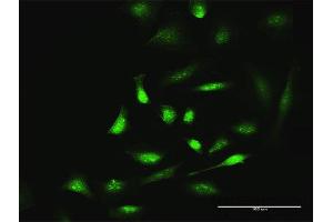 Immunofluorescence of purified MaxPab antibody to SIK1 on HeLa cell.