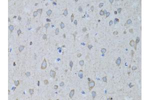 Immunohistochemistry of paraffin-embedded rat brain using GABARAP antibody (ABIN5973270) at dilution of 1/100 (40x lens). (GABARAP anticorps)