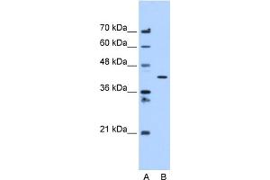 WB Suggested Anti-C20orf3 Antibody Titration:  1. (APMAP anticorps  (C-Term))