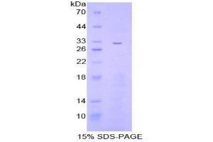 Inhibitory Subunit of NF-KappaB zeta protein