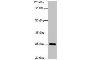 Western blot All lanes: GOSR2 antibody at 4 μg/mL + Jurkat whole cell lysate Secondary Goat polyclonal to rabbit IgG at 1/10000 dilution Predicted band size: 25, 23 kDa Observed band size: 25 kDa (GOSR2 anticorps  (AA 1-190))