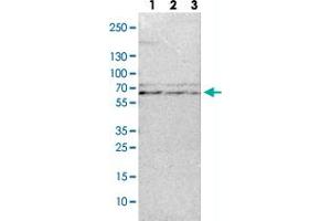 Western Blot (Cell lysate) analysis with TRAF3 polyclonal antibody  Lane 1: NIH-3T3 cell lysate (Mouse embryonic fibroblast cells) Lane 2: NBT-II cell lysate (Rat Wistar bladder tumour cells) Lane 3: PC12 cell lysate (Pheochromocytoma of rat adrenal medulla) (TRAF3 anticorps)