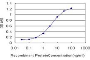 Detection limit for recombinant GST tagged GRK4 is approximately 0. (GRK4 anticorps  (AA 36-145))