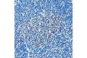 Immunohistochemistry of paraffin-embedded rat spleen using PAICS antibody.