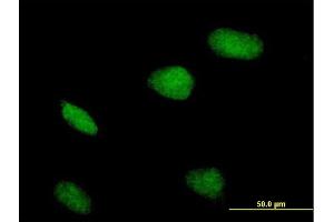 Immunofluorescence of purified MaxPab antibody to ZBTB32 on HeLa cell. (ZBTB32 anticorps  (AA 1-302))
